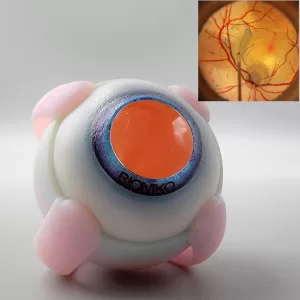 Fundus Advanced Model