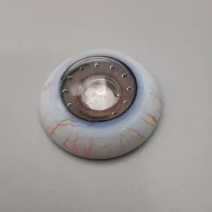 OKULO Laser Anterior Segment